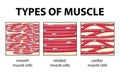 Types of muscle cell diagram