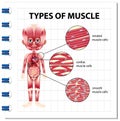 Types of muscle cell diagram