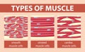 Types of muscle cell diagram