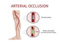 Types of Muscle tissue, anatomy, Vector Illustration on white background