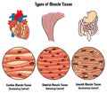 Types of Muscle Tissue of Human Body Diagram