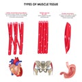 Types of muscle tissue. Realistic medical illustration.