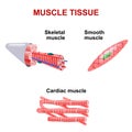 Types of muscle tissue