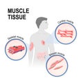 Types of muscle tissue. Royalty Free Stock Photo