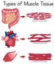 Types of Muscle Tissue Royalty Free Stock Photo