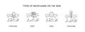 Types of neoplasms on the skin, line icon set in vector, papilloma and wart, mole and papilloma illustration.