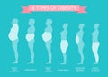 6 Types of Obesity. Male and female figure in profile. Royalty Free Stock Photo