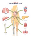 Types of organ transplants and inner body parts replacement outline diagram