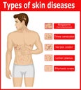 Types of skin diseases Royalty Free Stock Photo