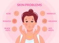 Types skin problems. Woman face with skins troubles, melasma pimple blemishes acne teenager problem blackhead cosmetic