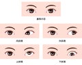 Types of strabismus vector illustration Royalty Free Stock Photo