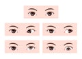 Types of strabismus vector illustration Royalty Free Stock Photo