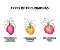 Types Trichomonads. Intestinal, oral, vaginal trichomonas structure. Trichomoniasis. Urogenital infection. Infographics. Vector