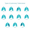 Types of tuberculosis. Vector silhouette medical illustration of human body organ