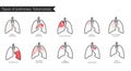 Types of tuberculosis. Vector silhouette medical illustration