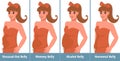 Types of Tummies for women. Overweight woman