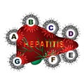 Types of viral hepatitis. Hepatitis A, B, C, D, E, F, G. World Hepatitis Day. Infographics. Vector illustration on