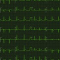Typical human electrocardiogram green graph on dark background, seamless pattern Royalty Free Stock Photo