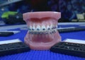 Typodont, plastic moulage of human jaws and teeth, and dental braces on it Royalty Free Stock Photo