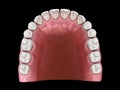 U-shape ovoid arch form of maxilla. Medically accurate tooth 3D illustration