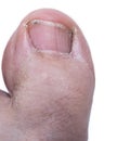 Ugly, Dirty, Weird Big Toe. Close up on white background