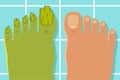 Ugly toes with a fungus foot. Vector