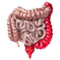 Ulcerative Colitis Digestive Medical Condition Royalty Free Stock Photo