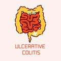 Ulcerative colitis poster