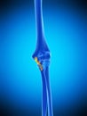 The ulnar collateral ligament Royalty Free Stock Photo