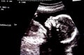 Ultra Sound portrait Royalty Free Stock Photo