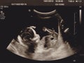 Ultrasonography