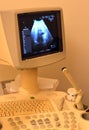 Ultrasonography on the uterus of a pregnant woman showing a healthy fetus, maternal ultrasound during pregnancy, pregnancy follow