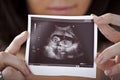 Ultrasound Royalty Free Stock Photo