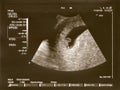 Ultrasound baby Royalty Free Stock Photo