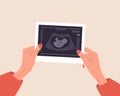 Ultrasound of baby. Female hands holding fetus silhouette photo. Embryo in womb. Pregnancy screening. Baby health