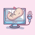 Ultrasound of baby heartbeat frecuncy and prescription