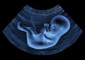 Ultrasound baby Royalty Free Stock Photo