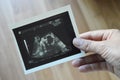 Image of ultrasound