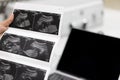 Ultrasound of baby in mother`s . Royalty Free Stock Photo