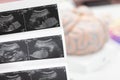 Ultrasound of baby in mother`s . Royalty Free Stock Photo