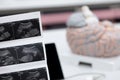 Ultrasound of baby in mother`s . Royalty Free Stock Photo