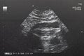 Ultrasound of baby in mother`s . Royalty Free Stock Photo