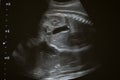 Ultrasound photo of unborn baby in mother`s womb, closeup view Royalty Free Stock Photo