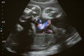 Ultrasound photo of unborn baby in mother`s womb, closeup view Royalty Free Stock Photo