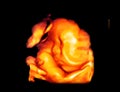 Ultrasound of baby in mother`s womb Royalty Free Stock Photo