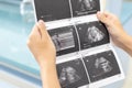 Ultrasound of baby in pregnant woman, Doctor reading test results of pregnant woman by ultrasound. Royalty Free Stock Photo