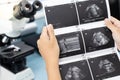 Ultrasound of baby in pregnant woman, Doctor reading test results of pregnant woman by ultrasound. Royalty Free Stock Photo