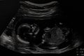 Ultrasound of baby in mother`s at hospital. Royalty Free Stock Photo