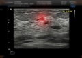 ultrasound breast of Patient after mammogram for diagnonsis Breast cancer in women isolated on black background