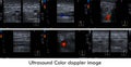 Ultrasound color doppler both leg. Royalty Free Stock Photo